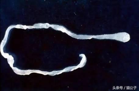 养猫会导致人得脑膜炎吗,养猫会让人得脑瘤吗