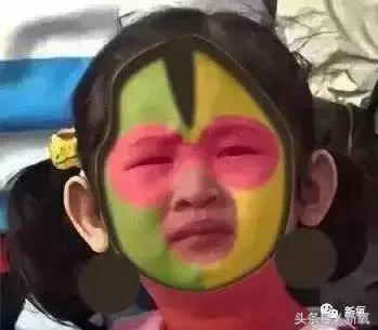 做了个达拉斯隆鼻,假体直接戳到脑门,我是不是和张檬、刘雨欣遇到了同一个医生!