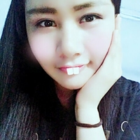 双眼皮松弛全切恢复过程,全切双眼皮几天可以洗脸