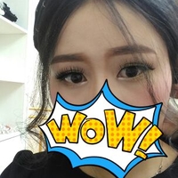 双眼皮松弛全切恢复过程,全切双眼皮几天可以洗脸