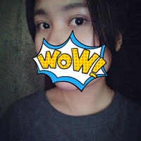 双眼皮松弛全切恢复过程,全切双眼皮几天可以洗脸