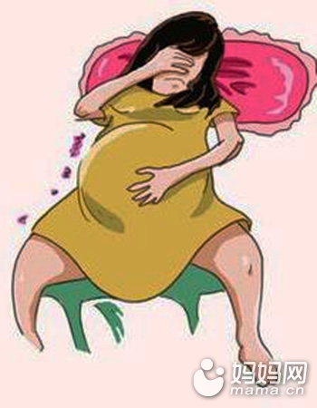 胎停育是优胜劣汰法则,胎停育真是优胜劣汰吗