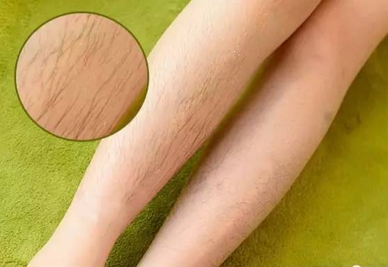 全球顶级脱毛膏,一款很牛的脱毛膏