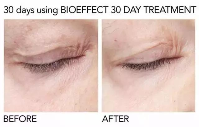 肌肤干燥、易脱妆、爱出油、质感差？我想你们应该还是有救的！