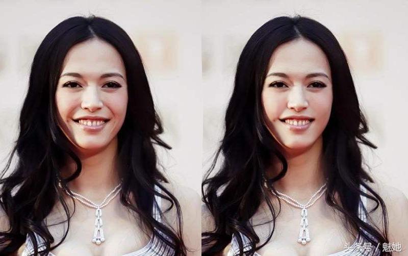 法令纹的种类和改善方法有哪些,法令纹怎么消除4妙招告别衰老