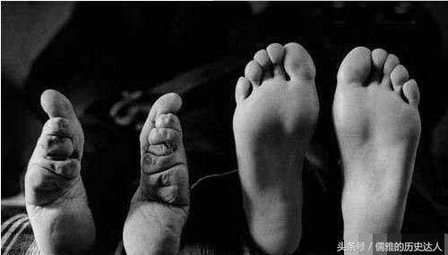 古代的缠足对女性的摧残有多大？为何古代男人们喜欢‘三寸金莲’