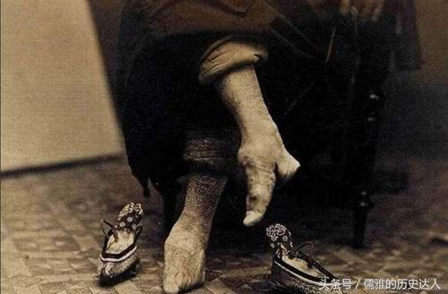 古代的缠足对女性的摧残有多大？为何古代男人们喜欢‘三寸金莲’