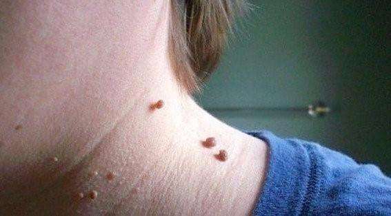 理发师号称养生治疾病，骗女子*款贷**20万办疗程，到底是什么病