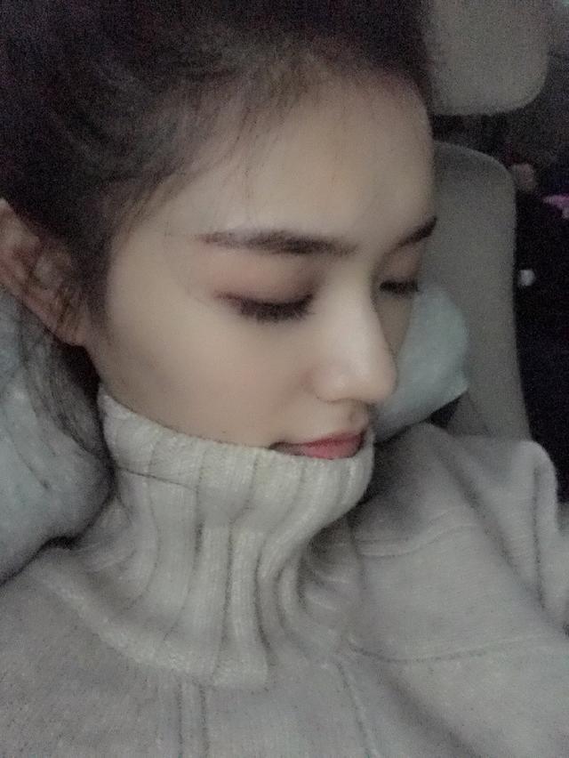 林允回应减肥前后对比,林允是不是整形了