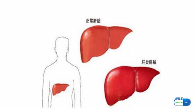 转氨酶高吃双环醇片多久可以降,转氨酶正常了还需要吃双环醇片吗