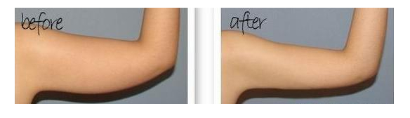 有什么方法瘦手臂,怎么瘦手臂最快最有效动作