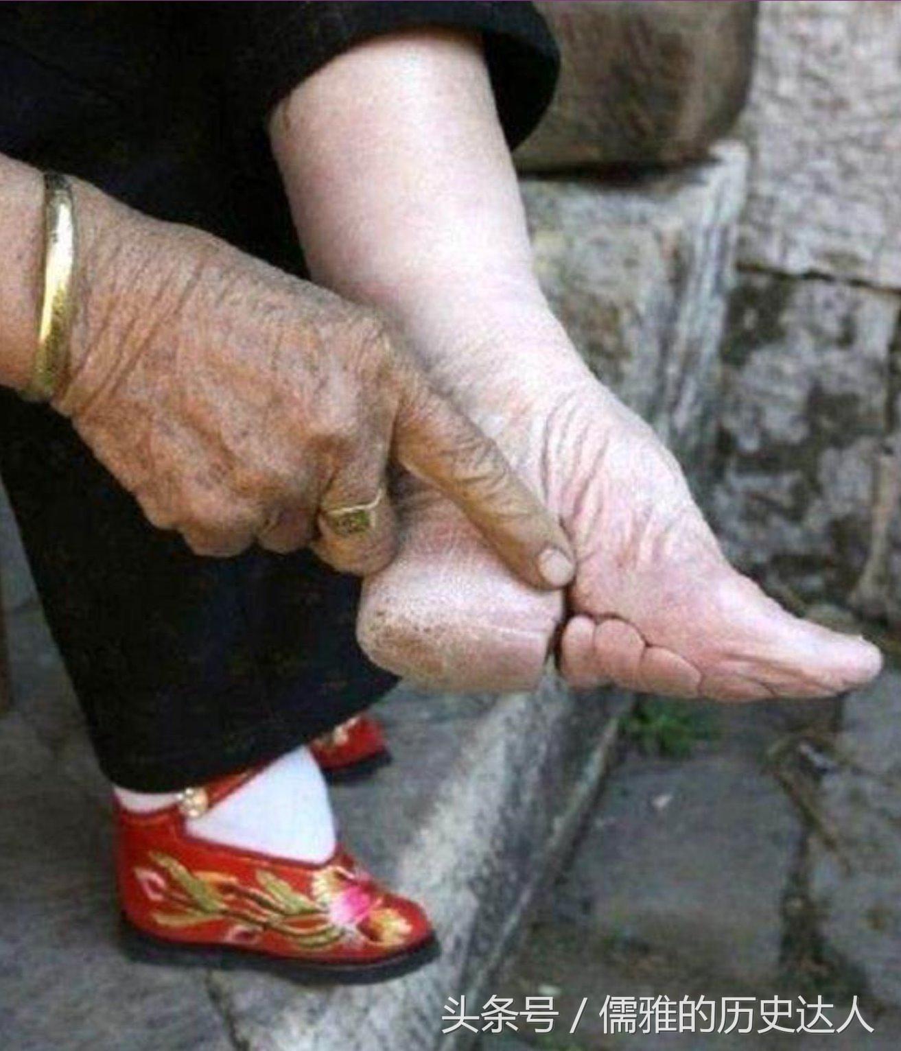 古代的缠足对女性的摧残有多大？为何古代男人们喜欢‘三寸金莲’