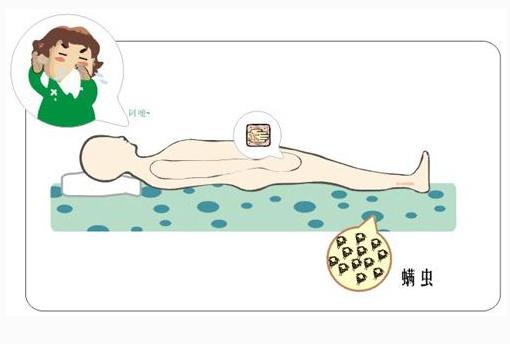 床上用品用什么洗可以去螨虫,清理床上螨虫小神器多少钱1个