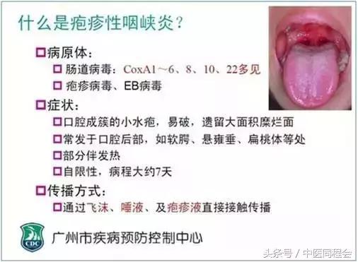 小儿发烧呼吸粗重,郭生白各种发烧的治法