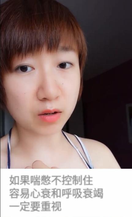 病毒性气管支气管炎症状,急性毛细支气管炎的最佳治疗