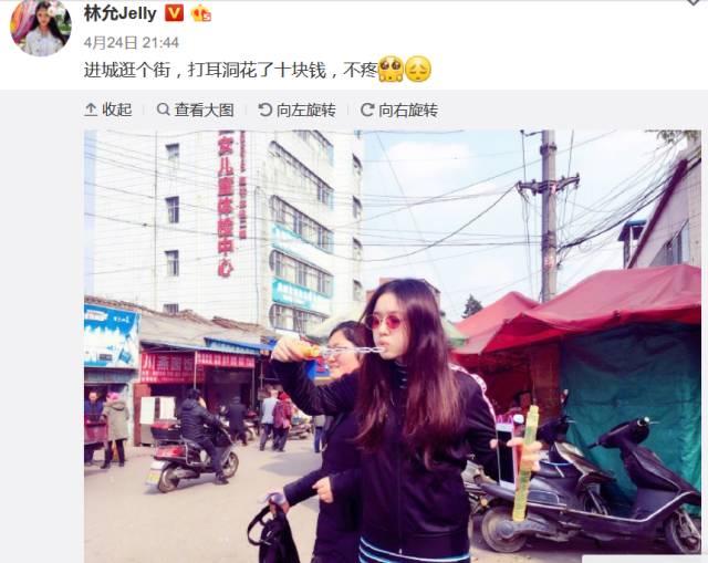 林允回应减肥前后对比,林允是不是整形了