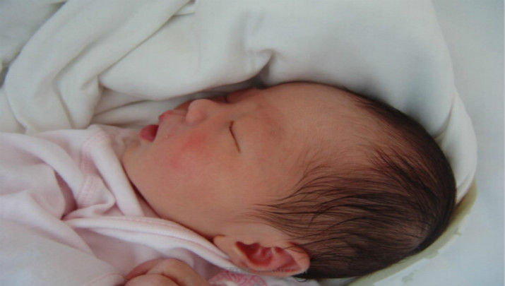 小儿黄疸退了又升了怎么办,小儿黄疸从出现开始多少天消退