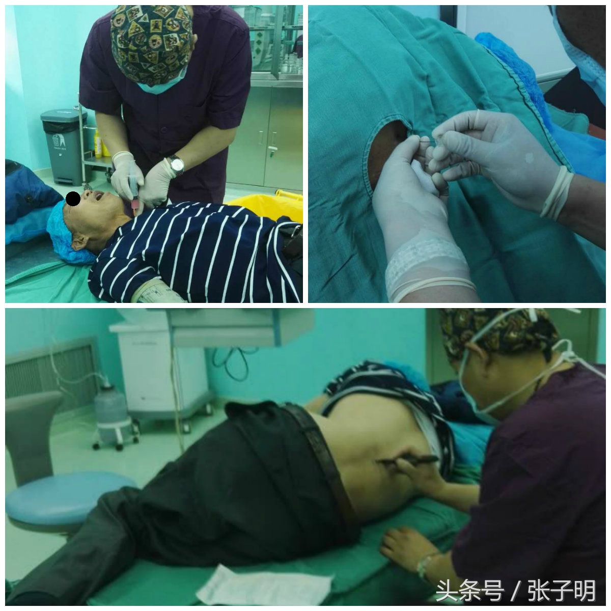 定西市二院疼痛门诊李长文主任妙手回春一针除病