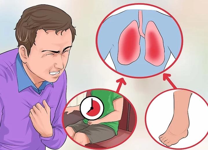 如何正确处理胸痛患者,突发胸痛急救最有效的方法