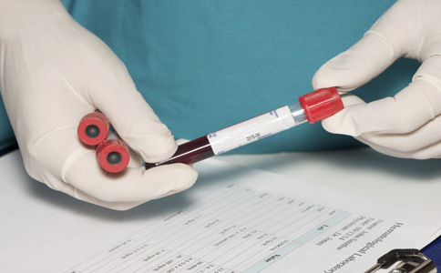 硬皮病确诊辅助检查,硬皮病确诊需做哪些检查