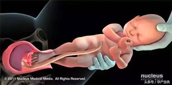 妇产科医生讲解整个分娩过程,妇产科产程讲解