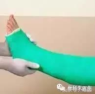 踝关节骨折和踝关节扭伤哪个严重,踝关节扭伤康复治疗注意事项