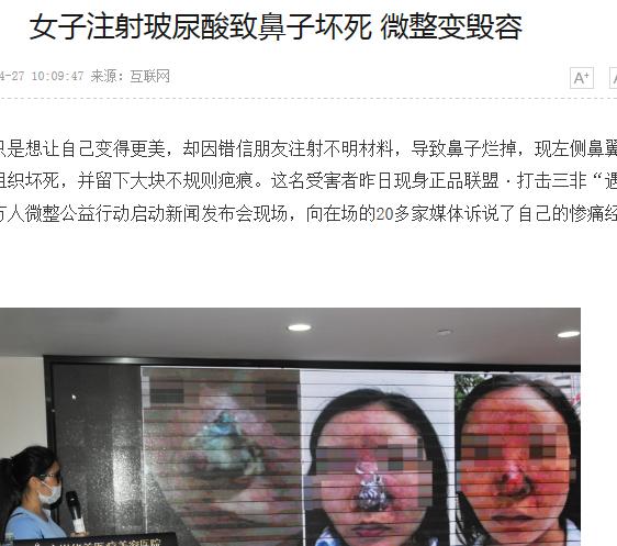 娱乐圈不老小妖精们的诀窍,玻尿酸的一二事儿~