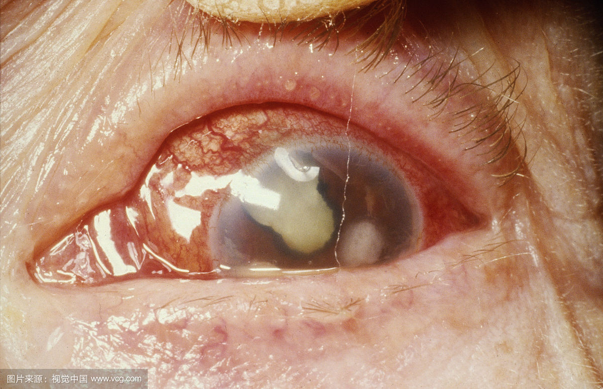 睡着五分钟做了一个梦,凌晨4点多做的梦是真的吗