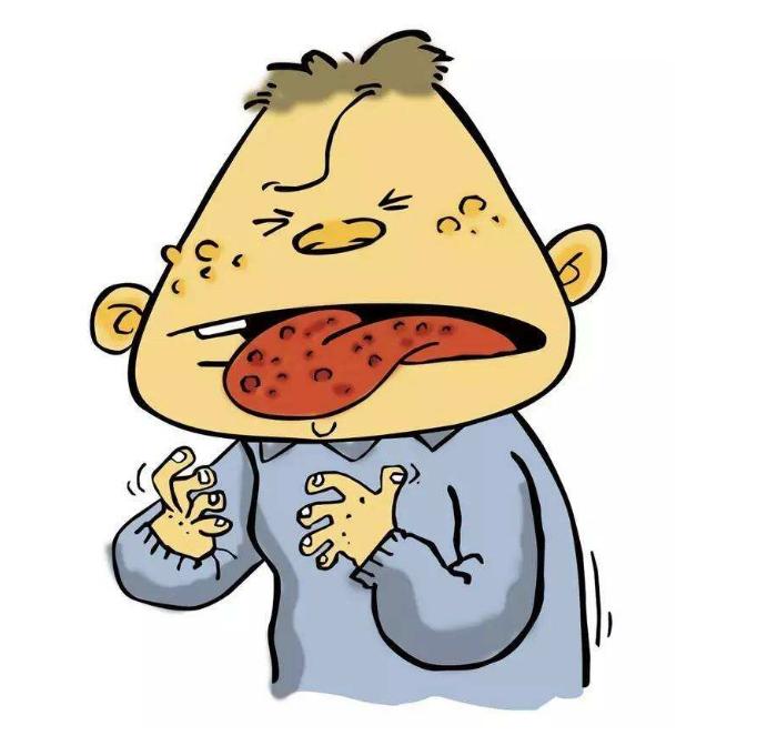 口腔溃疡中医辨证治疗及方药,口腔溃疡中医用药规律分析