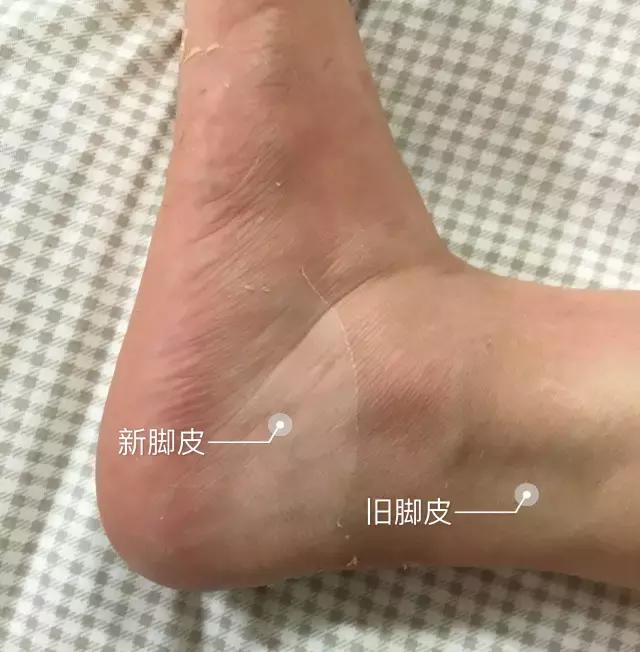 日本热销药妆,日本爆款药妆店