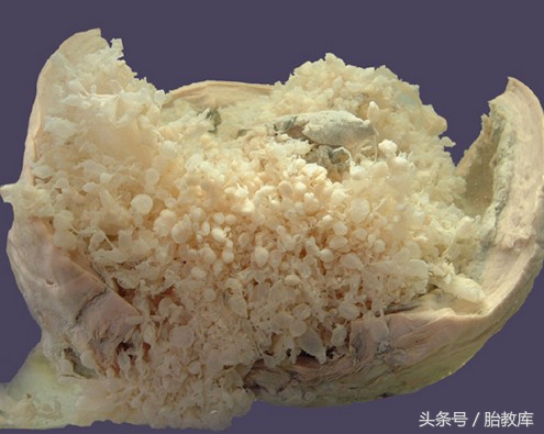 怀孕6个月有轻微出血什么原因,怀孕6周突然大出血是什么原因