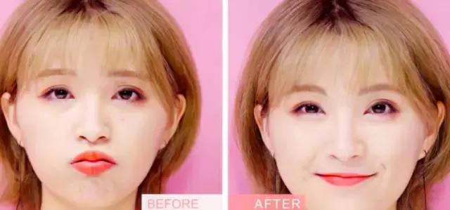 烂脸救星爆痘,烂脸救星成烂脸神器