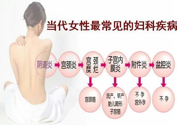 只要坚持锻炼身体就能增强体质,保护卵巢的有效运动方法