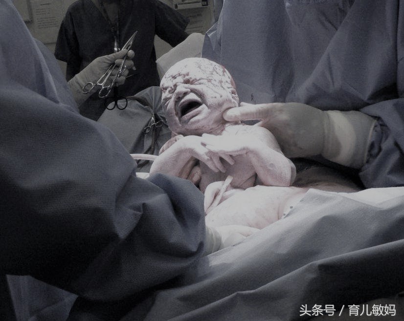 21岁孕妇死活要求剖腹产,医生问出原因后,老公却说这很正常