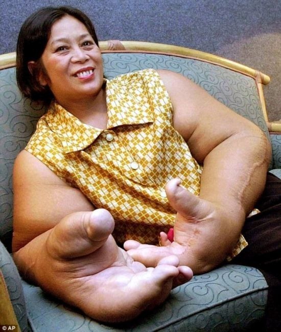 如此大的器官怎么长的，都打破吉尼斯记录了，看到第一个已我服了