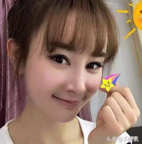 做了个达拉斯隆鼻,假体直接戳到脑门,我是不是和张檬、刘雨欣遇到了同一个医生!