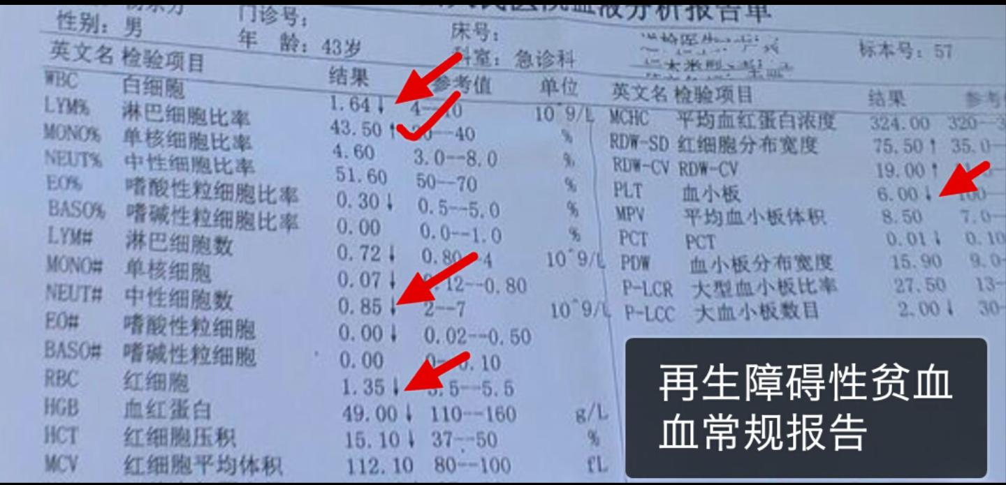血常规报告单数据可以看出贫血,地中海贫血的血常规报告单怎么看