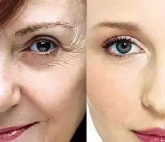 女明星和网红都爱的玻尿酸,保湿、除皱、抗初老,不到百元!