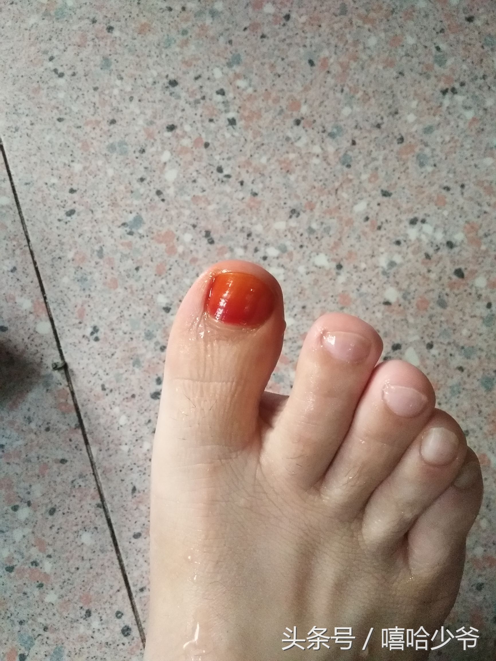 农村纯天然指甲草,神奇的指甲草有几种