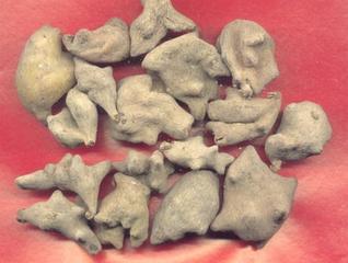 慢性湿疹吃什么止痒,治疗慢性湿疹十大中成药如何治