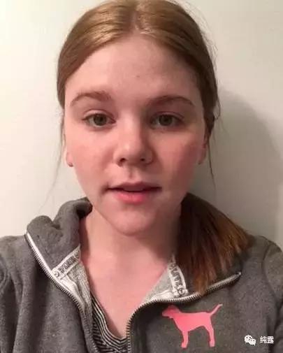 如何制定一个适合自己的纯露补水方案