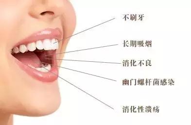 有口臭怎么解决不用药,有口臭应该吃什么药