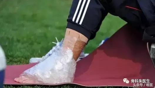 踝关节骨折和踝关节扭伤哪个严重,踝关节扭伤康复治疗注意事项