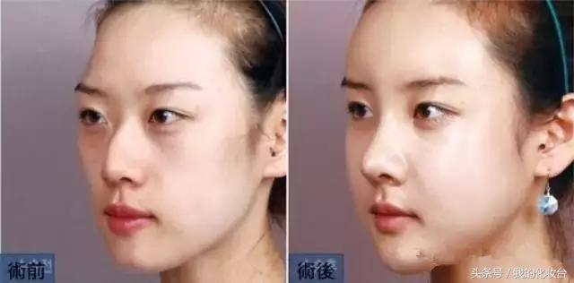 所以说你们想要的“少女颜”是怎么养成的呢？