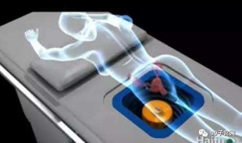 海扶治疗子宫肌瘤的适应症,海扶医疗子宫肌瘤