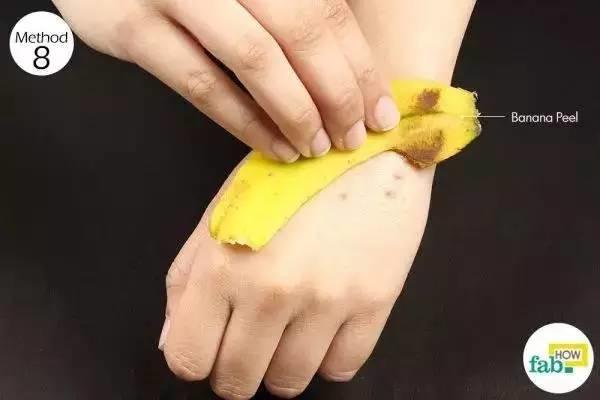 蚊子咬了最有效的止痒方法,蚊子咬了有什么止痒方法