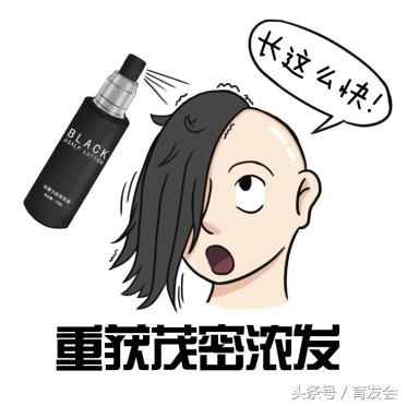 全世界治疗脱发的新发明,世界脱发最新治疗技术