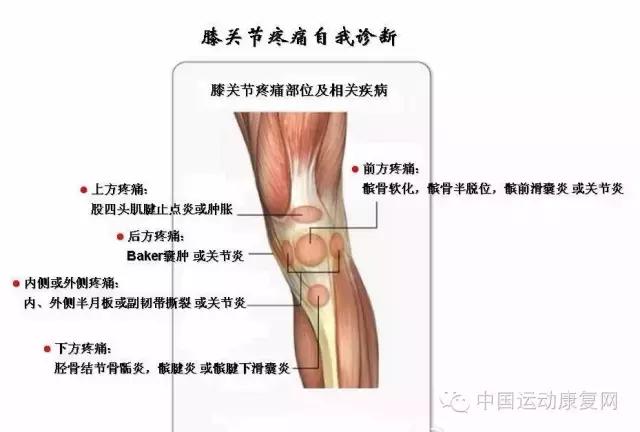 运动之后膝关节痛是怎么回事,运动后导致膝盖疼