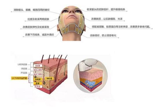 为什么超声做的结果不一样呢,超声刀效果是什么