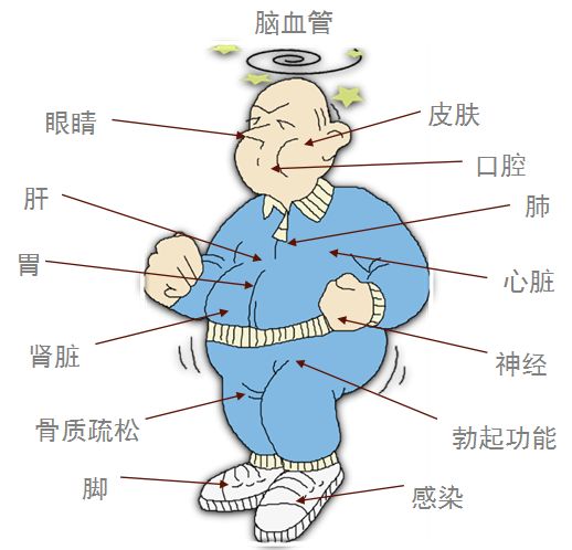 肥胖引起的血糖高怎么快速降下来,肥胖患者降血糖应该怎么做